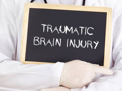 Doctor shows traumatic brain injury sign, Victorville brain injury lawyer concept