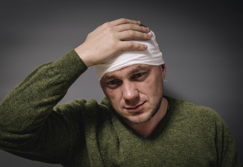 Irvine traumatic brain injury lawyer concept man with head injury