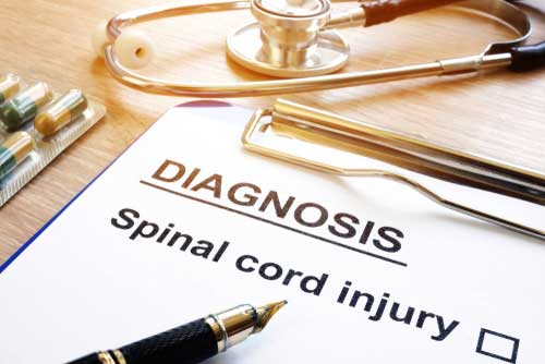 Santa Ana spinal cord injury lawyer concept spinal cord injury diagnosis